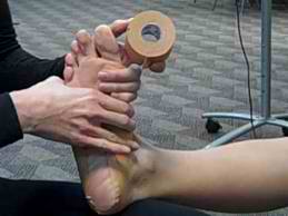 Taping-Bunions