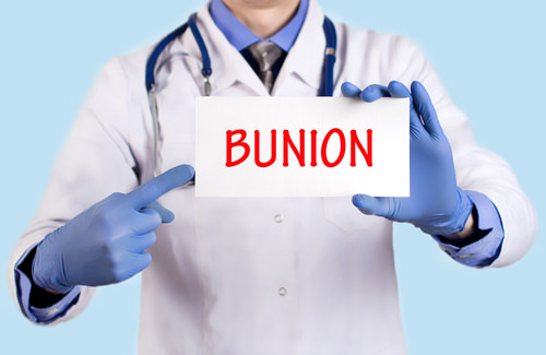 Bunion treatment without surgery