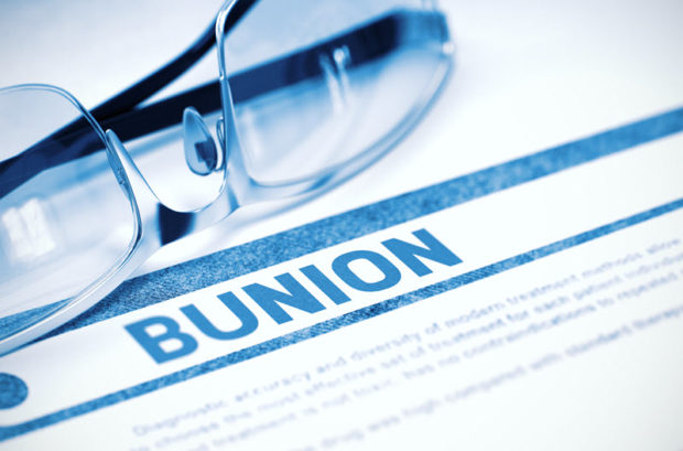 Treatments for Bunion Pain