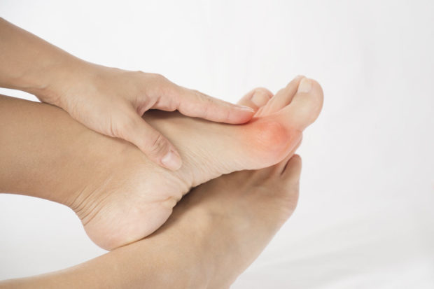 non-surgical ways to alleviate bunion pain