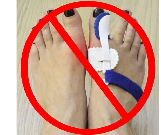 Bunion Correctors